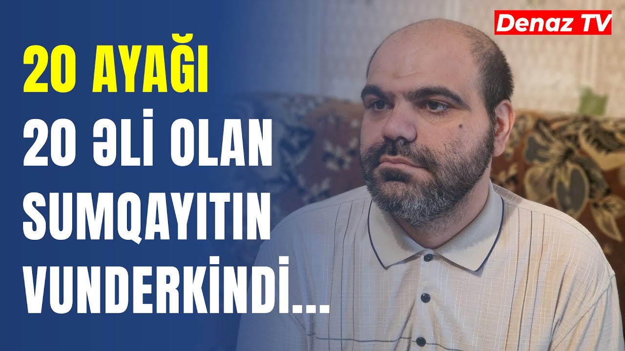 20 Ayağı 20 Əli Olan Sumqayıtlı Vunderkind: Qız Məni Sevərsə Evlənərəm...