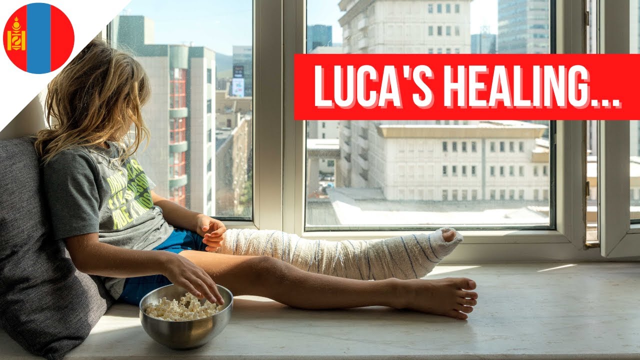 Luca's broken leg healing during our time in Mongolia
