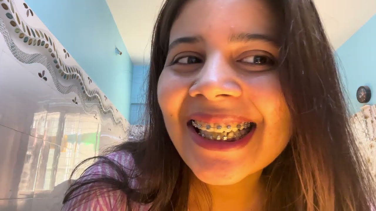 10 Months 17 day Braces journey #viral #trending #dentalcare #teeth #braces #youtuber#viralvideo 