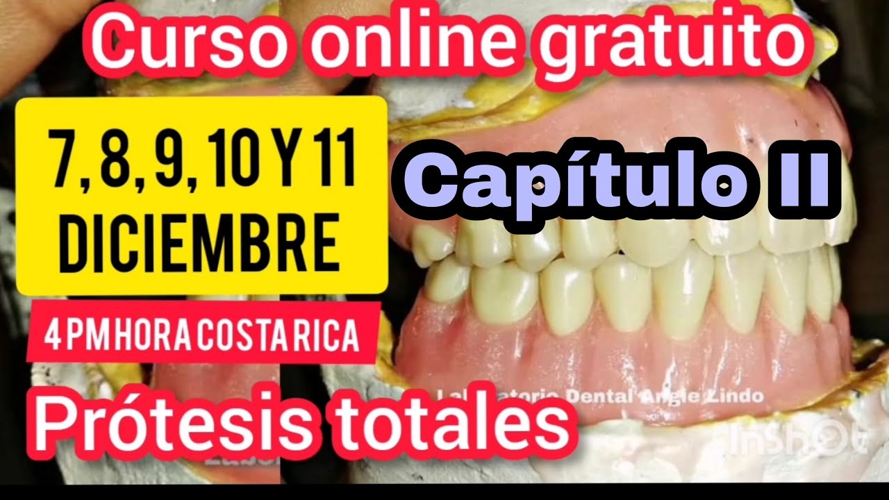 Curso PRÓTESIS TOTALES Capítulo 2