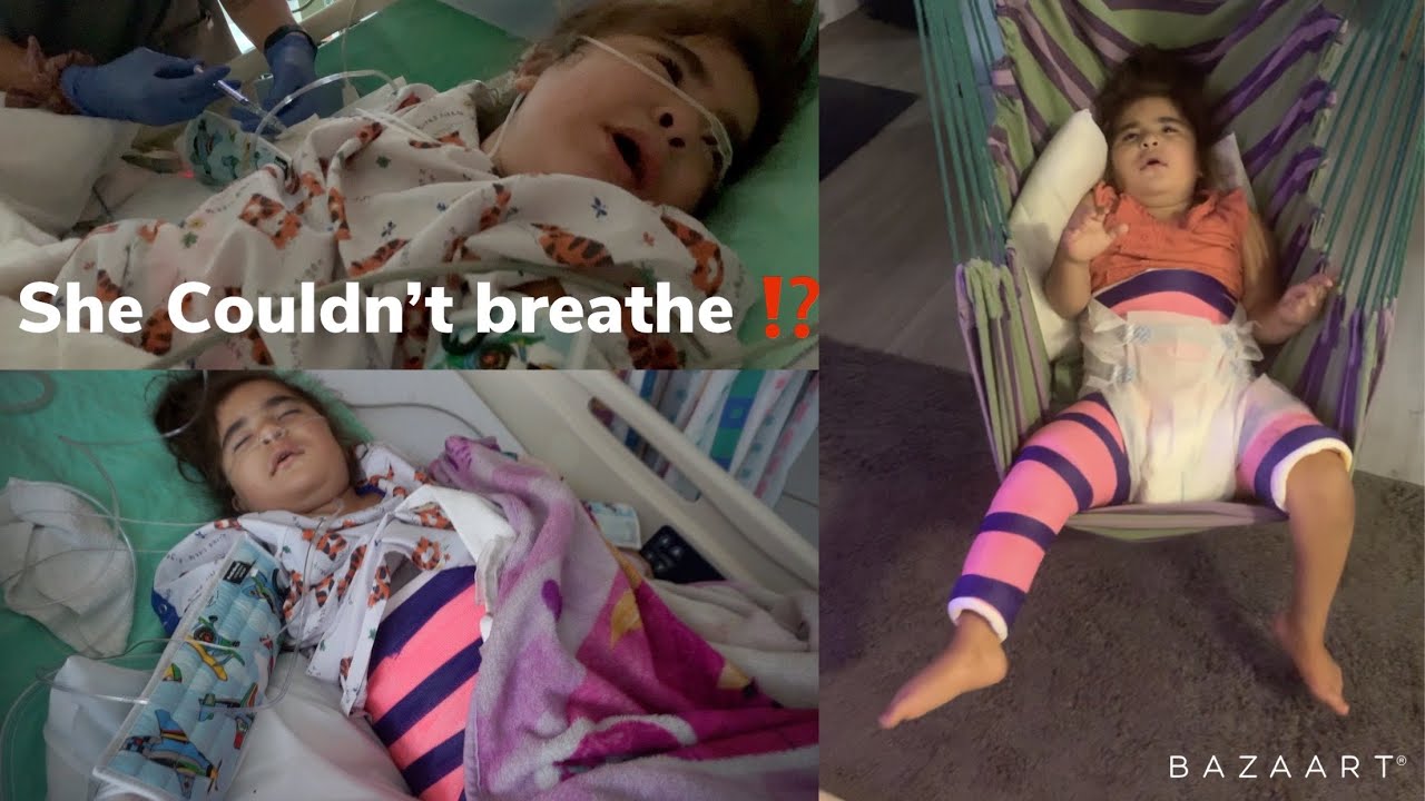 Hip dysplasia surgery | Leg cast spica cast