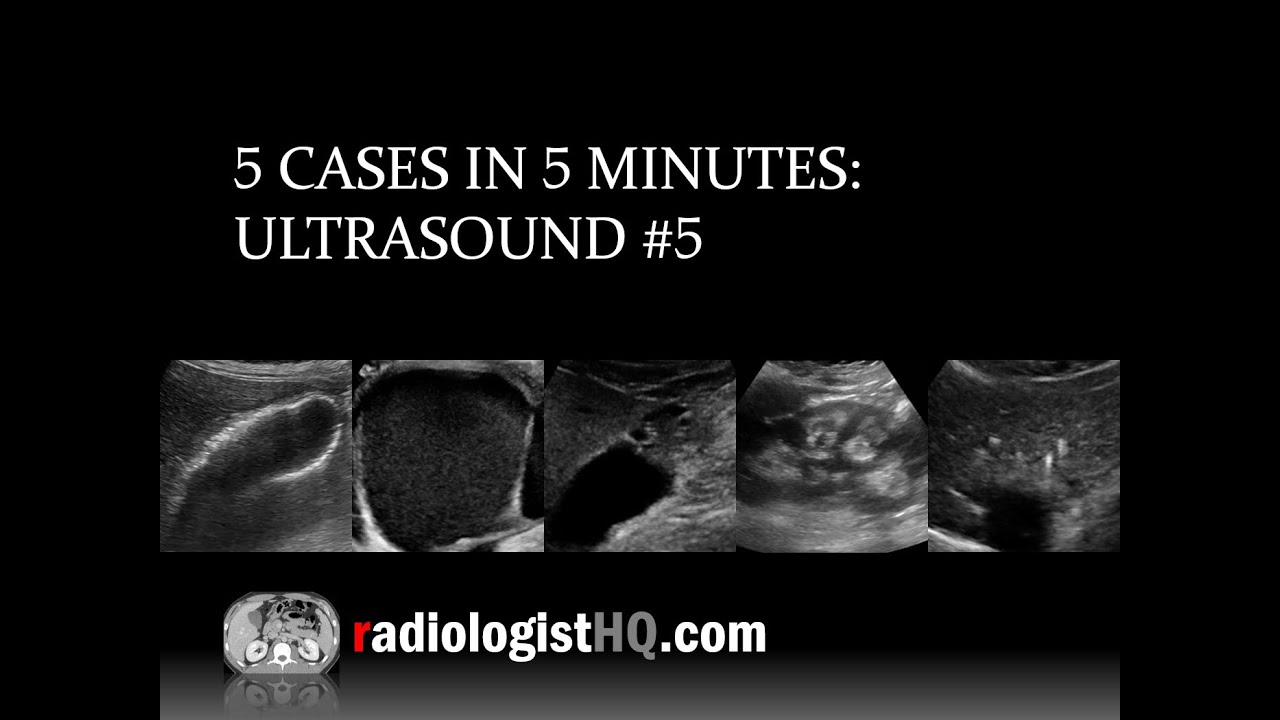 5 Cases in 5 Minutes: Ultrasound #5