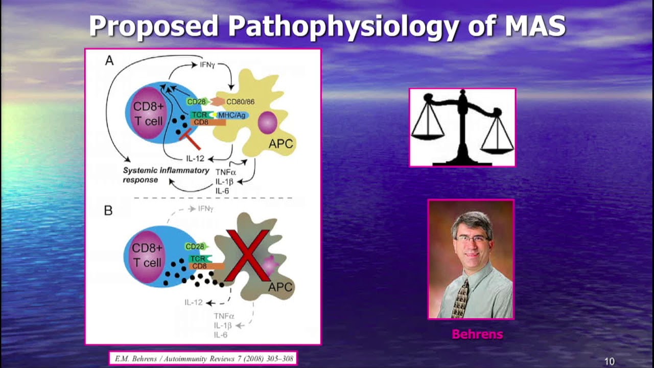 Clinical Trial of Anakinra (Interleukin 1 Receptor Antagonist) in MAS - Randy Cron