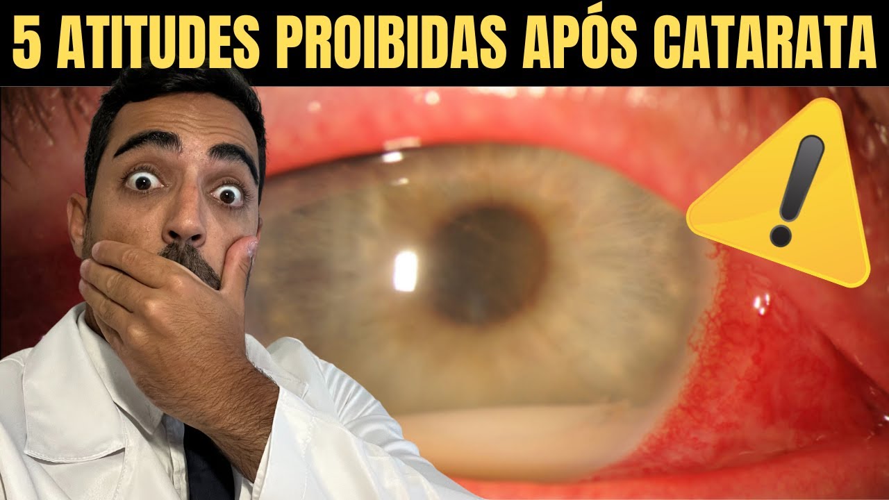 NUNCA FAÇA ISSO APÓS OPERAR CATARATA