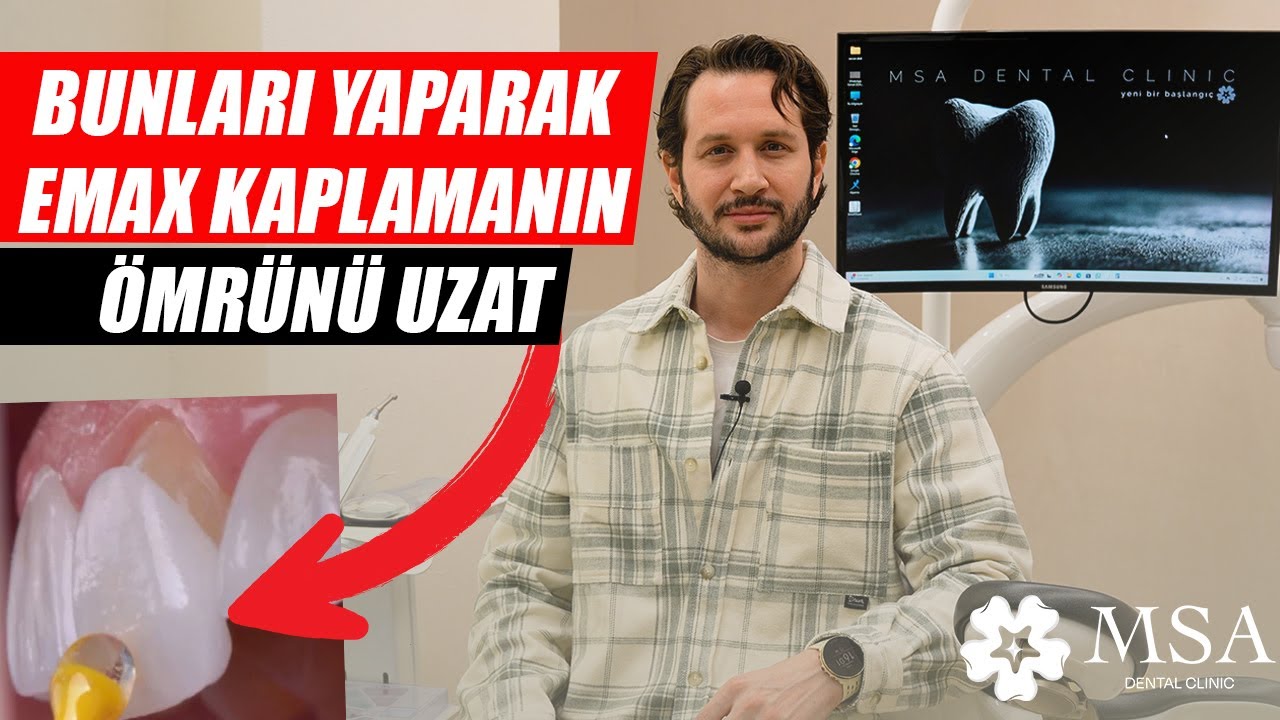 EMAX Kaplama Sonrası Dikkat Edilmesi Gerekenler