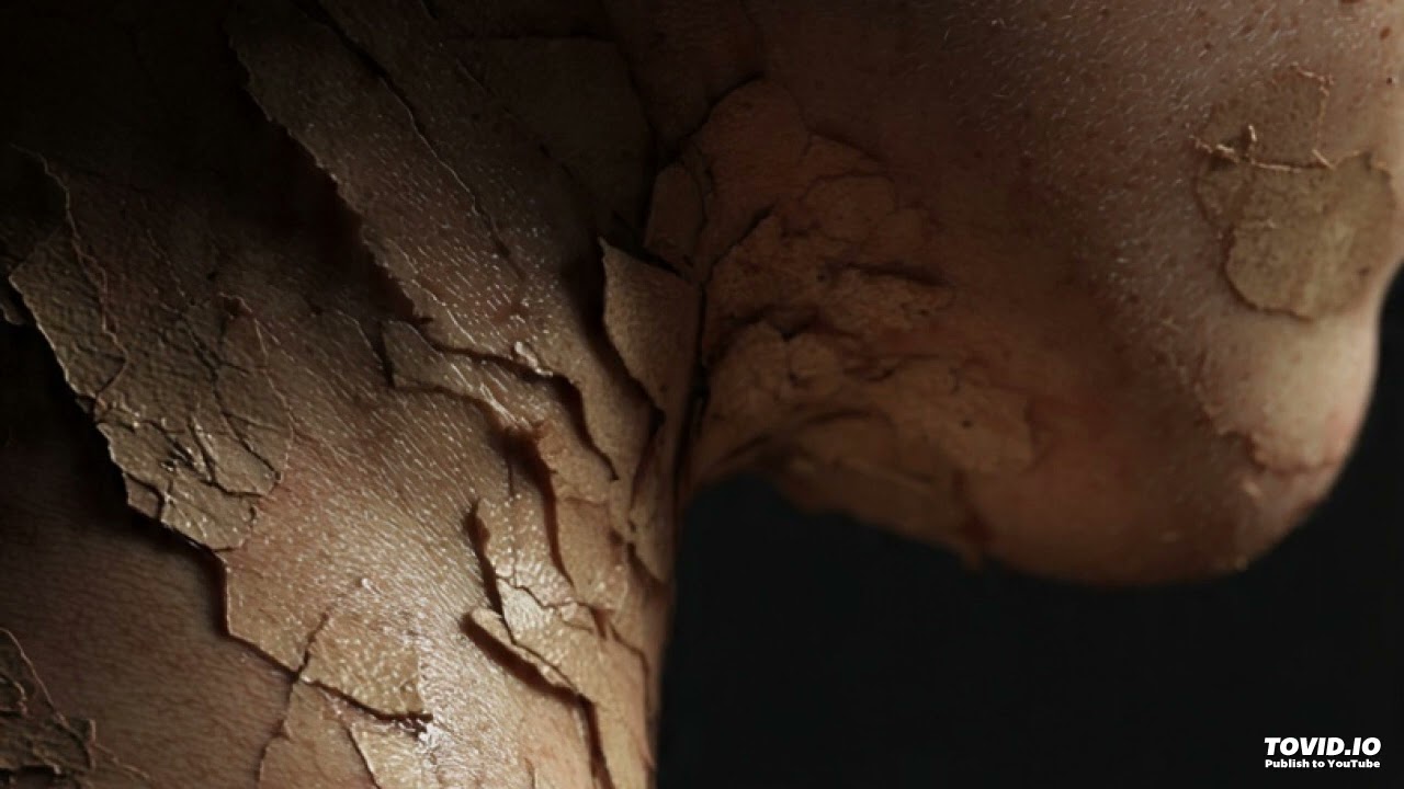 Shedding Your Skin