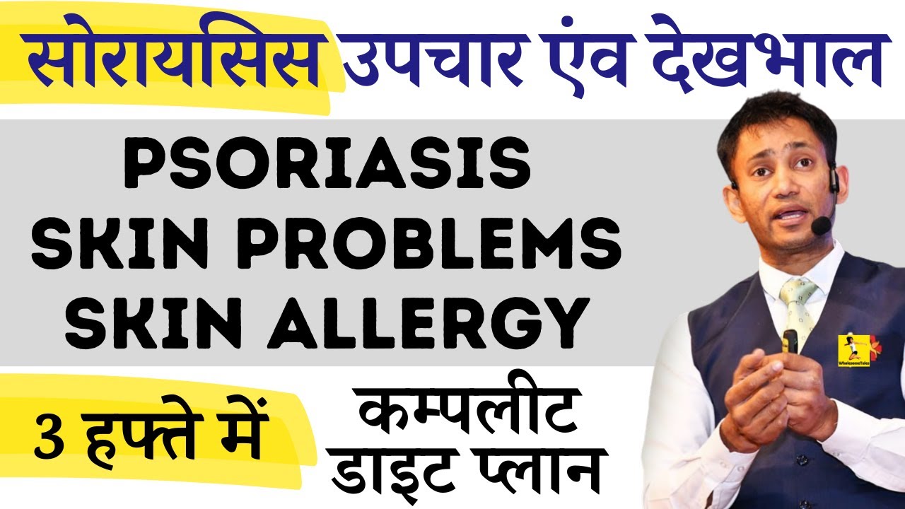 Dr Biswaroop (PhD) - सोरायसिस उपचार एंव स्व-देखभाल Diet for Psoriasis, Skin Problems, Skin Allergy