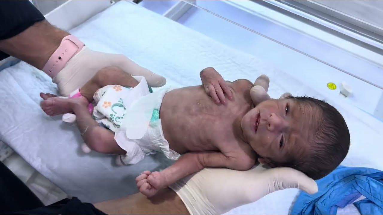 28-Week Premature Baby  NICU Care Journey  Preterm Baby Progress Update