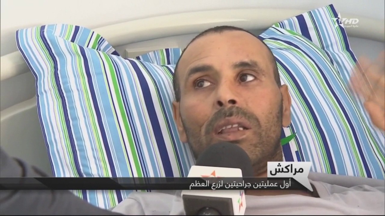 إجراء أولى عمليات زرع العظم 