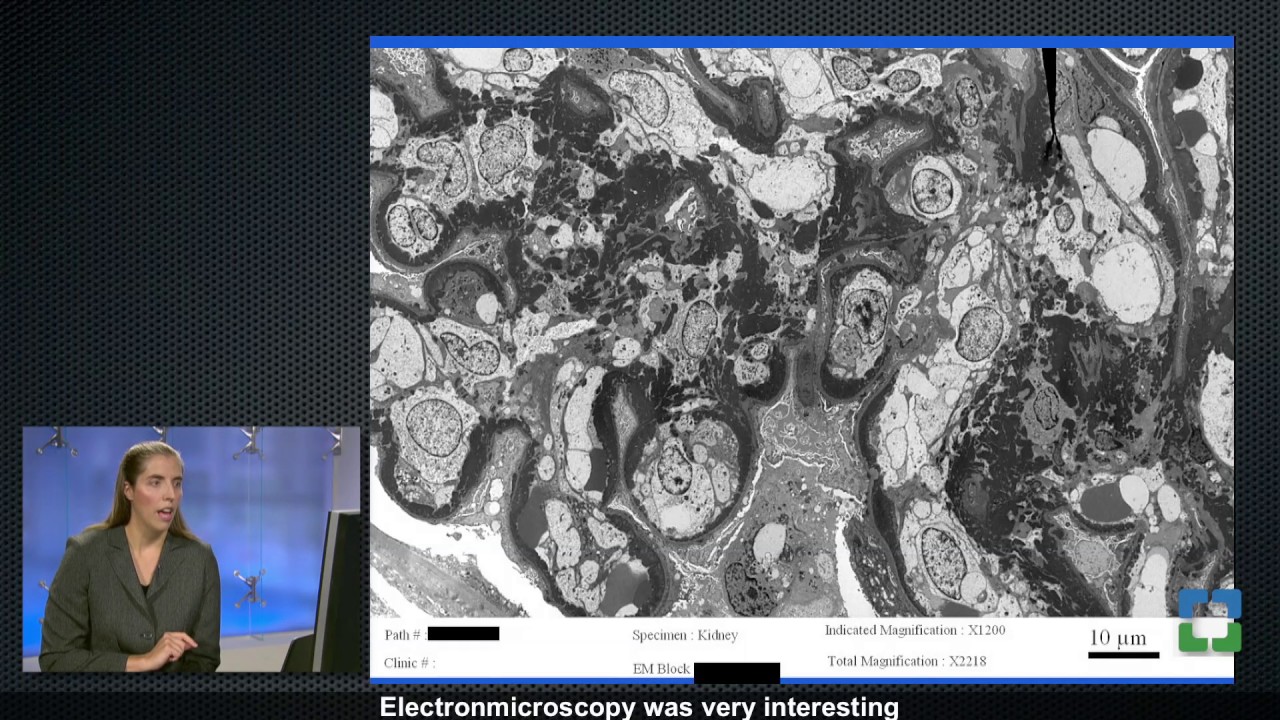 Pathology Insights - Medical Kidney Pathology with Leal Herlitz, MD