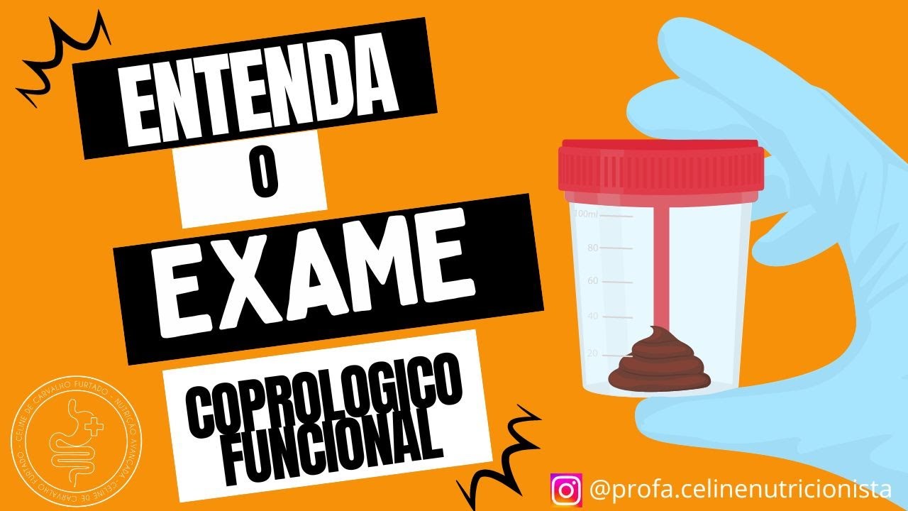 Entenda que exame é esse e para ele serve