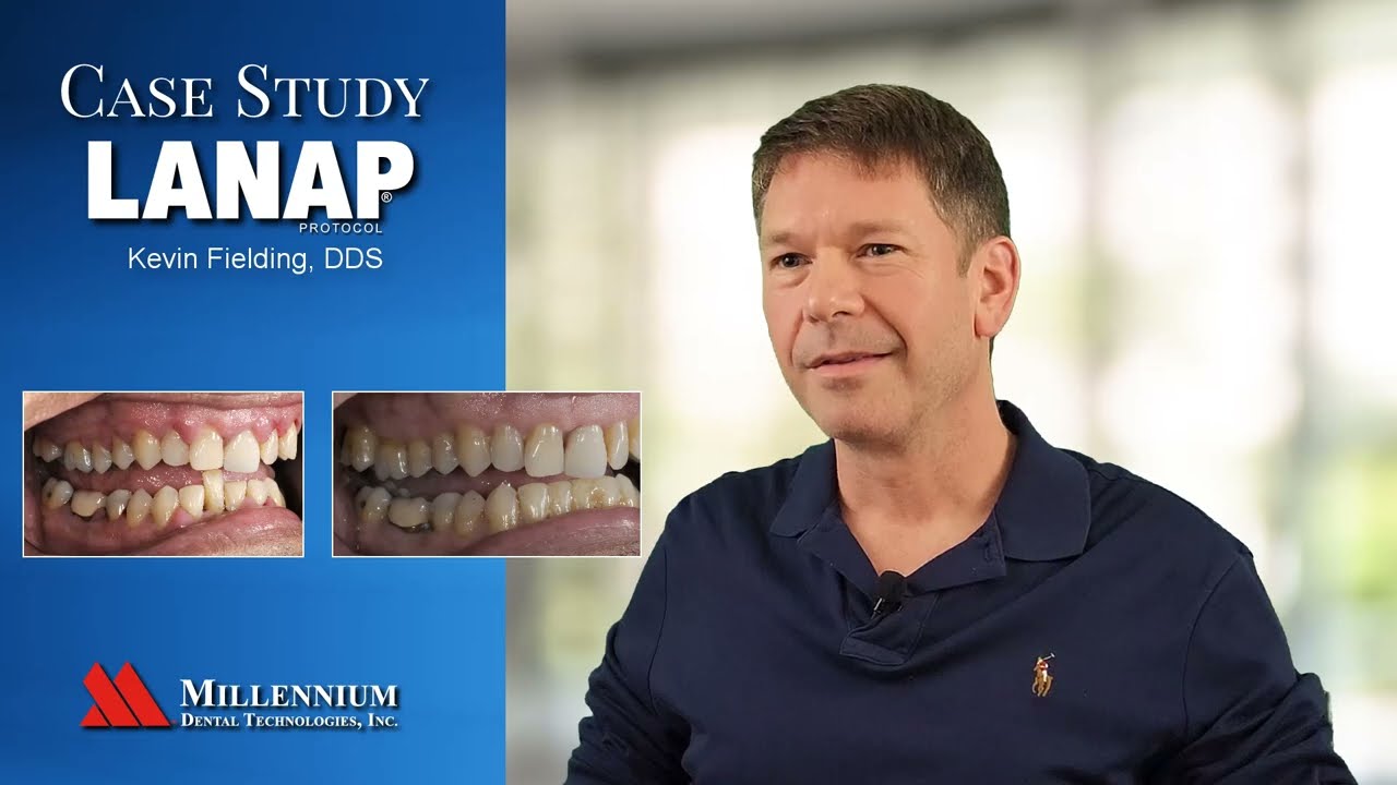 LANAP Case Study by Kevin Fielding, DDS - see why Dr Fielding says the results are mind blowing!