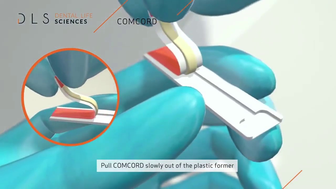 Comcord Composite For Supporting Dental Restorations