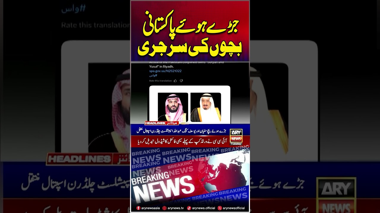 Conjoined Pakistani Twins Separation Surgery #saudiarabia #shorts #arynews