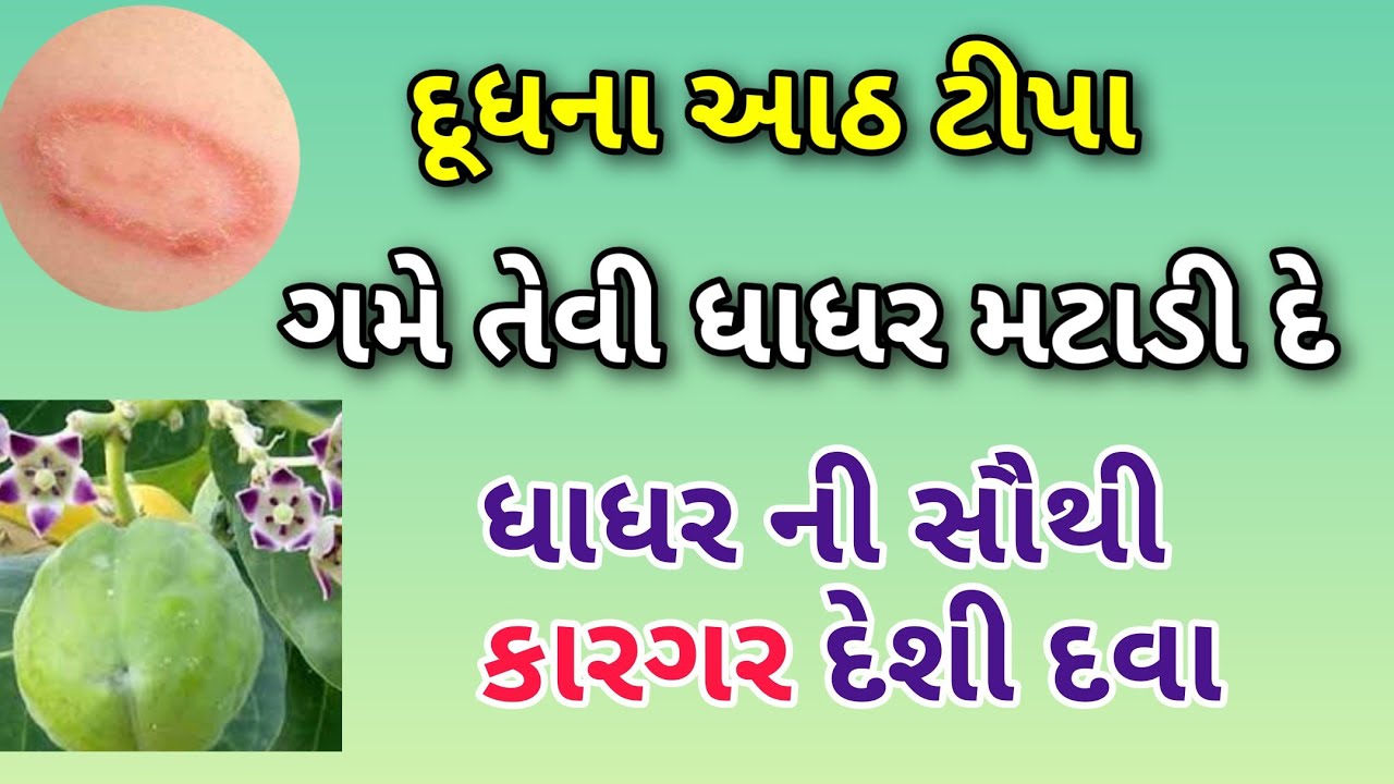 આ દૂધના આઠ ટીપા ગમે તેવી ધાધર મટાડી દે ||ધાધર ખરજવા ની દેશી દવા || Dhadhar ko kaise hataye