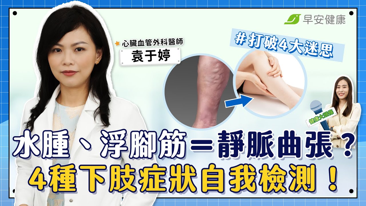 小腿水腫、浮腳筋＝靜脈曲張恐血管堵塞？醫師教你4種下肢症狀自我檢測！｜袁于婷 心臟血管外科醫師【早安健康Ｘ健康大頭條】
