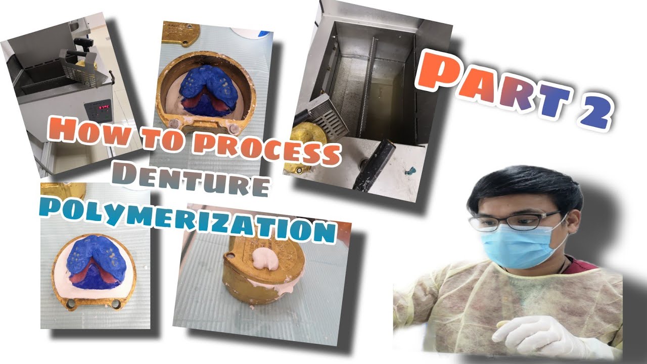 How to process Denture polymerization Part 2