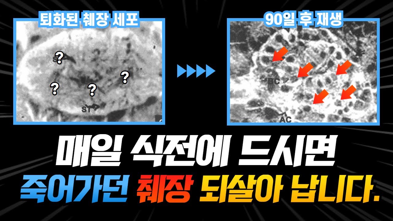 췌장을 되살려 당뇨를 탈출하는 영양소, 아직 늦지 않았습니다. 한국인 당뇨 특화