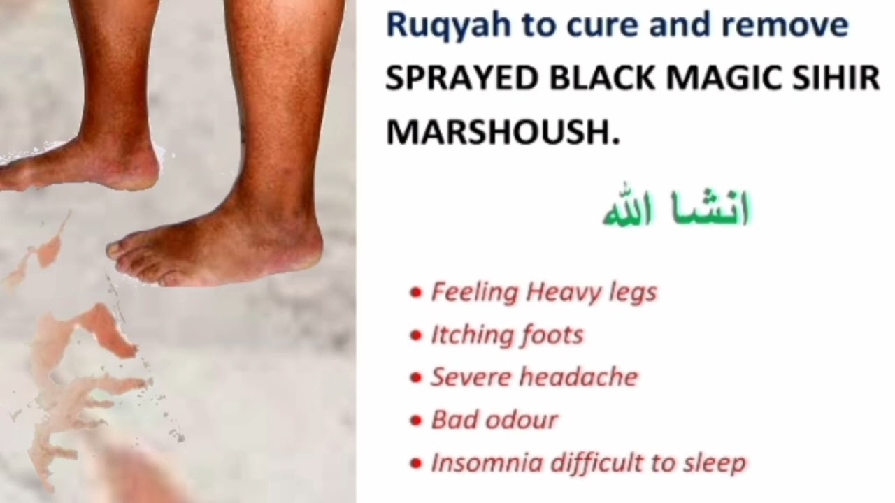 RUQYA FOR SPRAYED BLACK-MAGIC: STEPPED ON OR TOUCHED ( SIHIR MARSHUSH)
