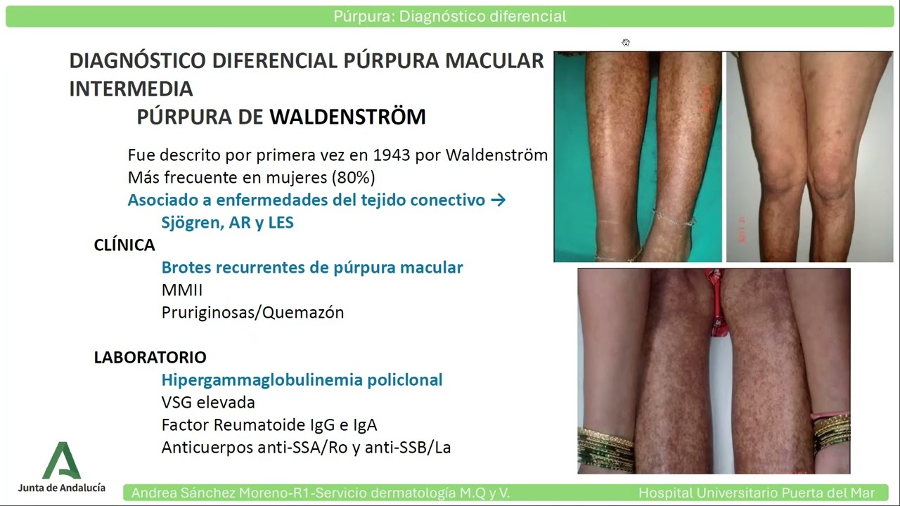 Diagnóstico diferencial de la púrpura cutánea