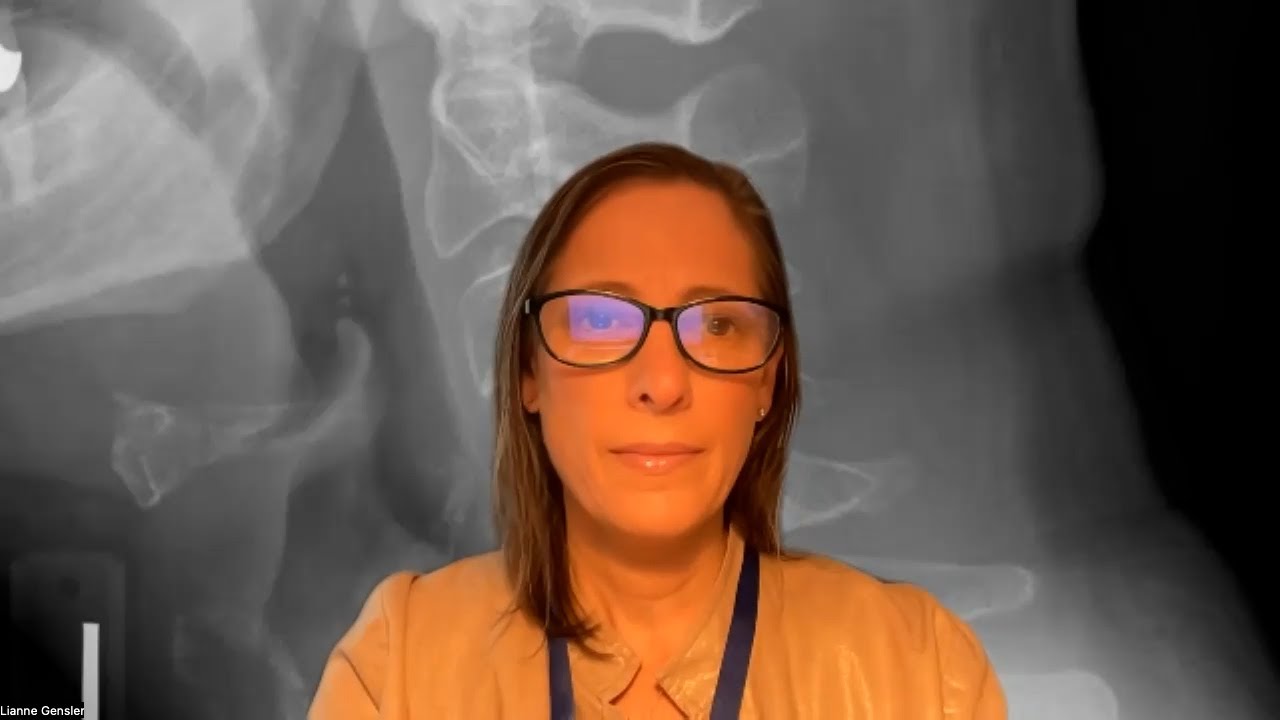 Treatment Considerations in Axial Spondyloarthritis
