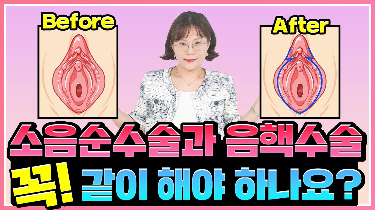 소음순 수술과 음핵 성형 꼭 같이해야 할까? ( 강남 산부인과 )
