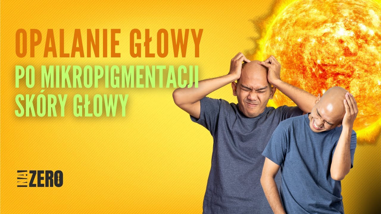 Opalanie głowy a mikropigmentacja skóry głowy. Czy po zabiegu SMP można się opalać?