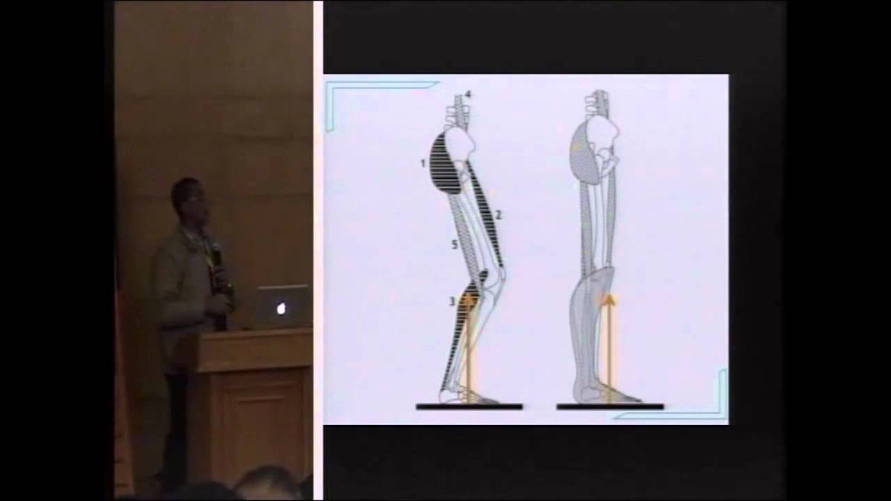 Spastic Diplegia