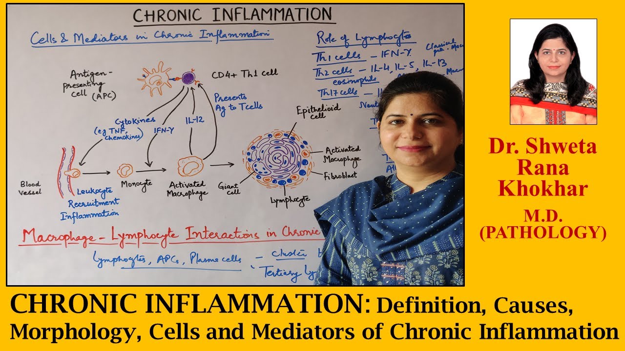 Chronic Inflammation: Definition, Causes, Morphology, Cells and Mediators of Chronic Inflammation