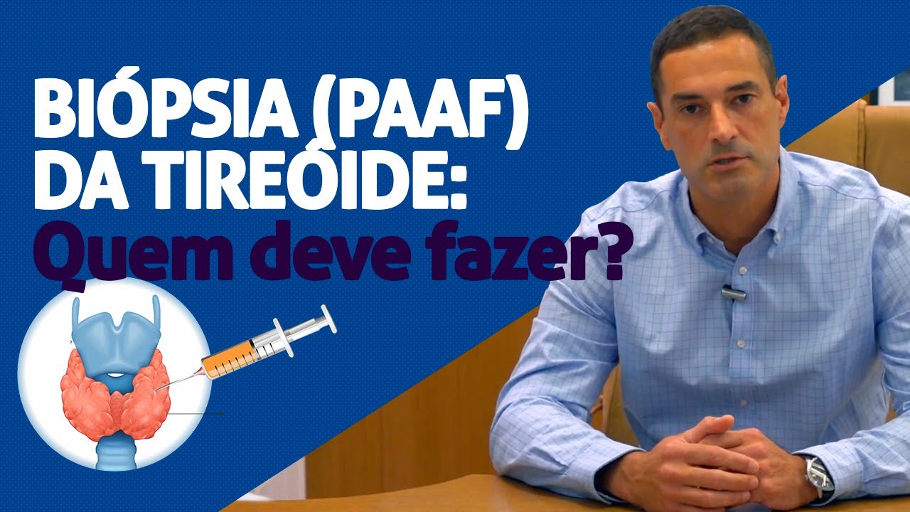 QUAIS NÓDULOS DEVEM FAZER A PAAF (BIÓPSIA) DA TIREÓIDE?