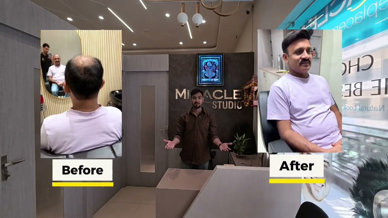 1 घंटे में Confidence Boost | Natural Hair Look👉🏻 Miracle Hair Replacement Studio 📞 +91 70232 29018