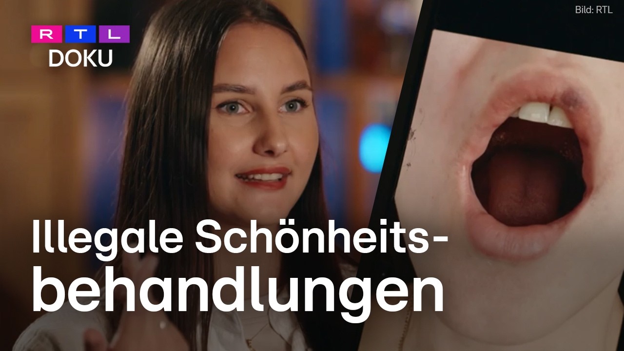 Die Welt der Schönheitsbetrüger – So gefährlich sind illegale Behandlungen! | EXTRA - Das Magazin