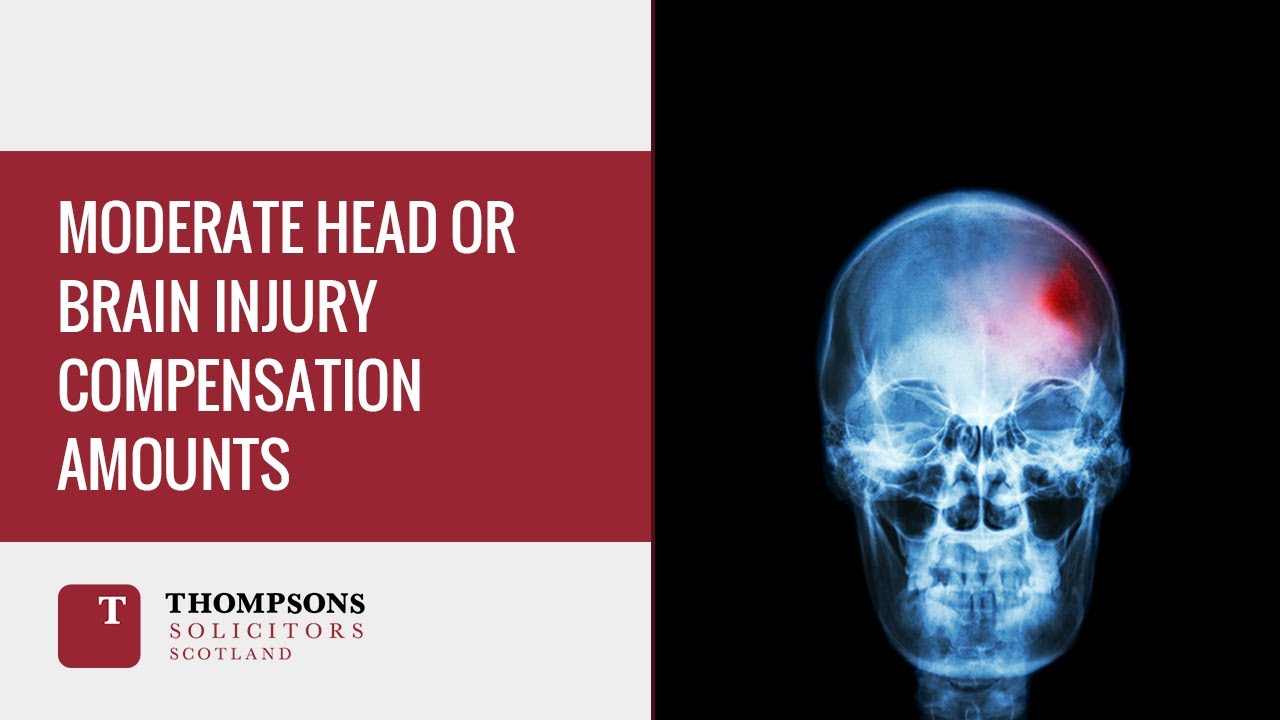 Moderate Head or Brain Injury Compensation Amounts