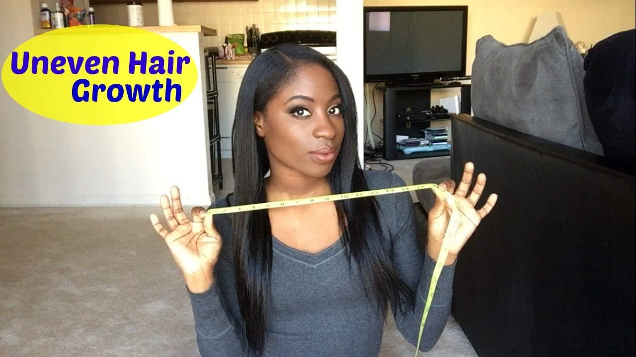 Uneven Hair Growth!