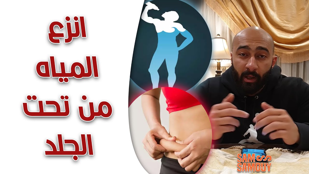 كيفية التخلص من احتباس الماء تحت الجلد | ساموي