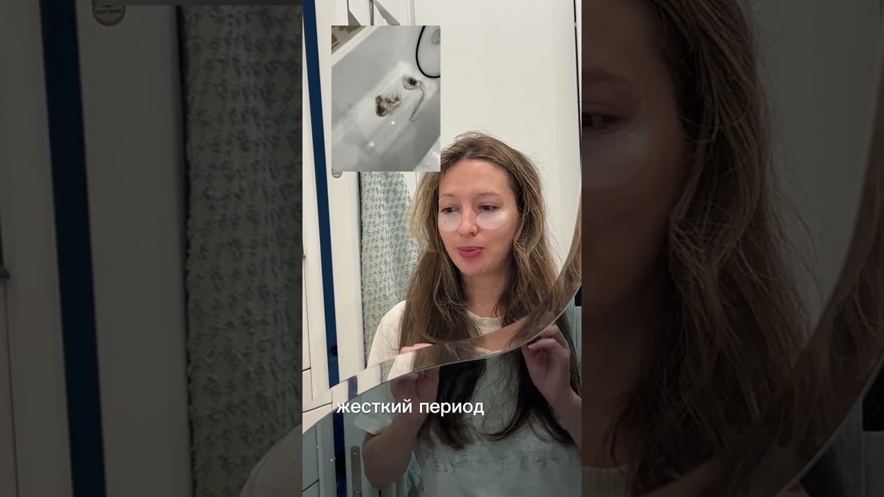 Выпадение волос / как не остаться лысой после беременности и родов/ 