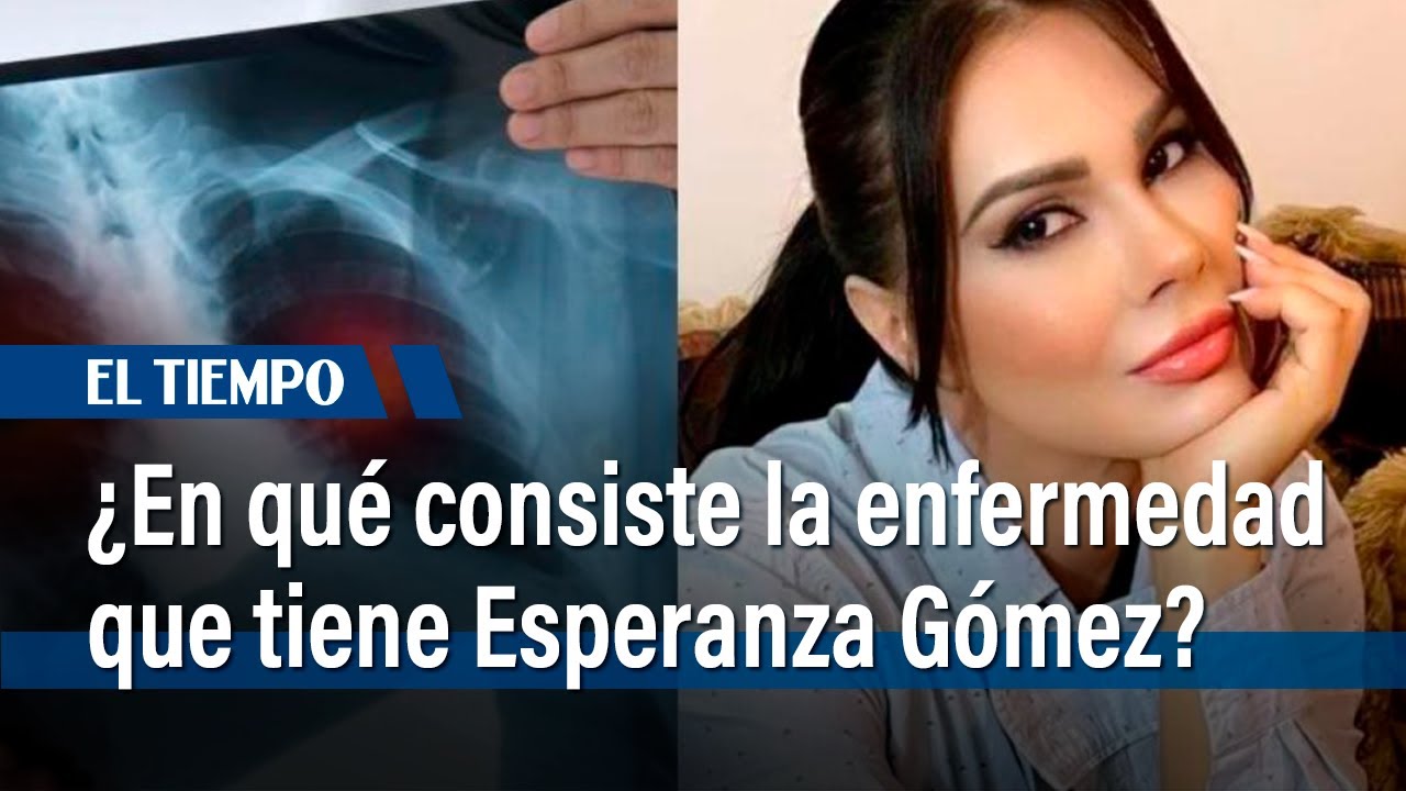 Esperanza G&oacute;mez: &iquest;En qu&eacute; consiste la enfermedad que la tiene al borde del retiro?