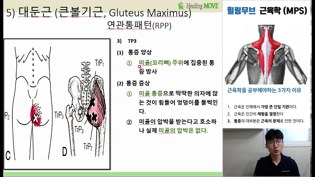 [힐링무브 근육학] 5-3-(2) 대둔근(큰볼기근, Gluteus maximus) 의 통증유발점과 관리방법 | 골반통증, 엉덩이 통증, 허벅지 통증시 확인 | healingmove