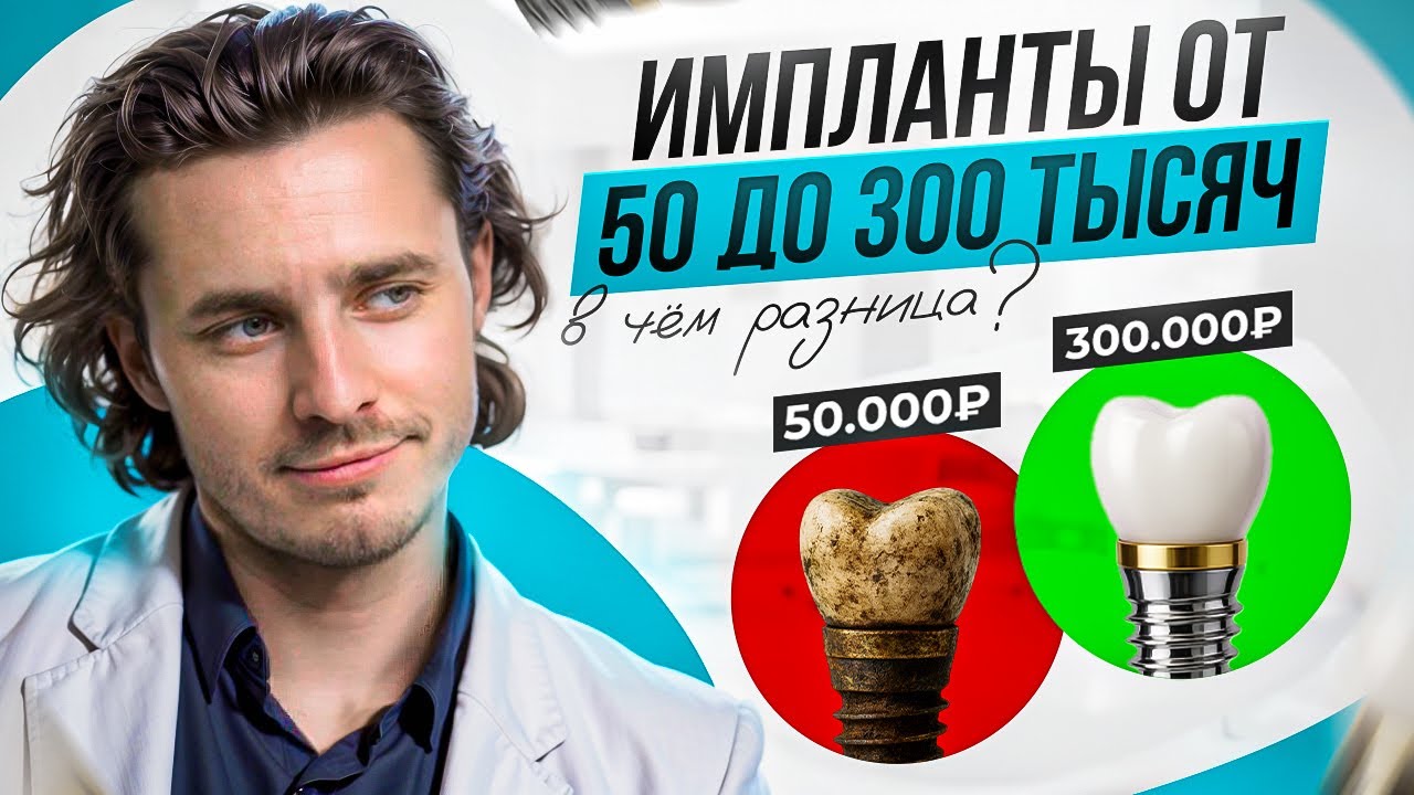 ТОП 3 лучших имплантов 2025! Какие реально ставят врачи?