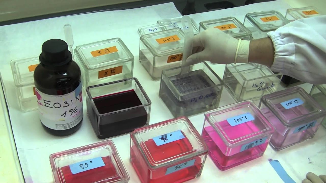 Tinción con hematoxilina y eosina