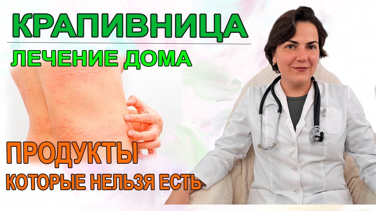 Крапивница, лечение в домашних условиях. Аллерголог Екатерина Екатерина Цывкина
