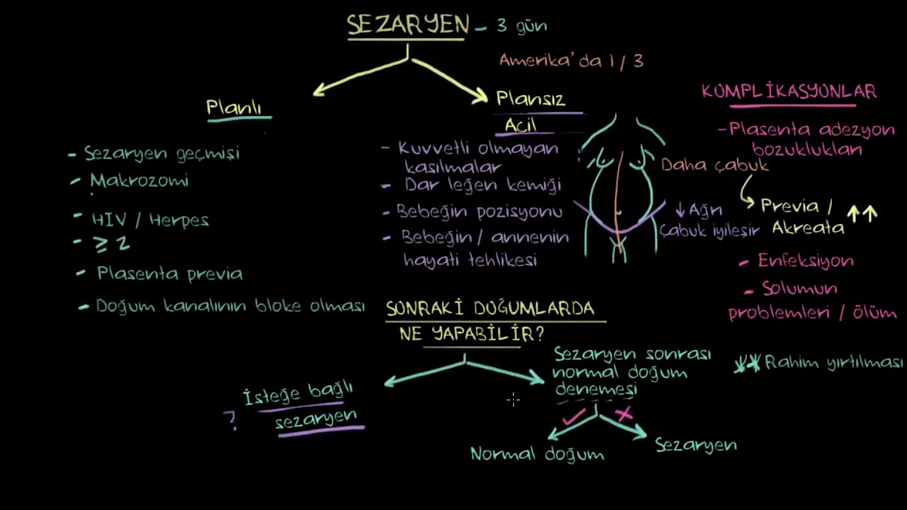 Sezaryen Doğum (Sağlık Bilgisi ve Tıp)