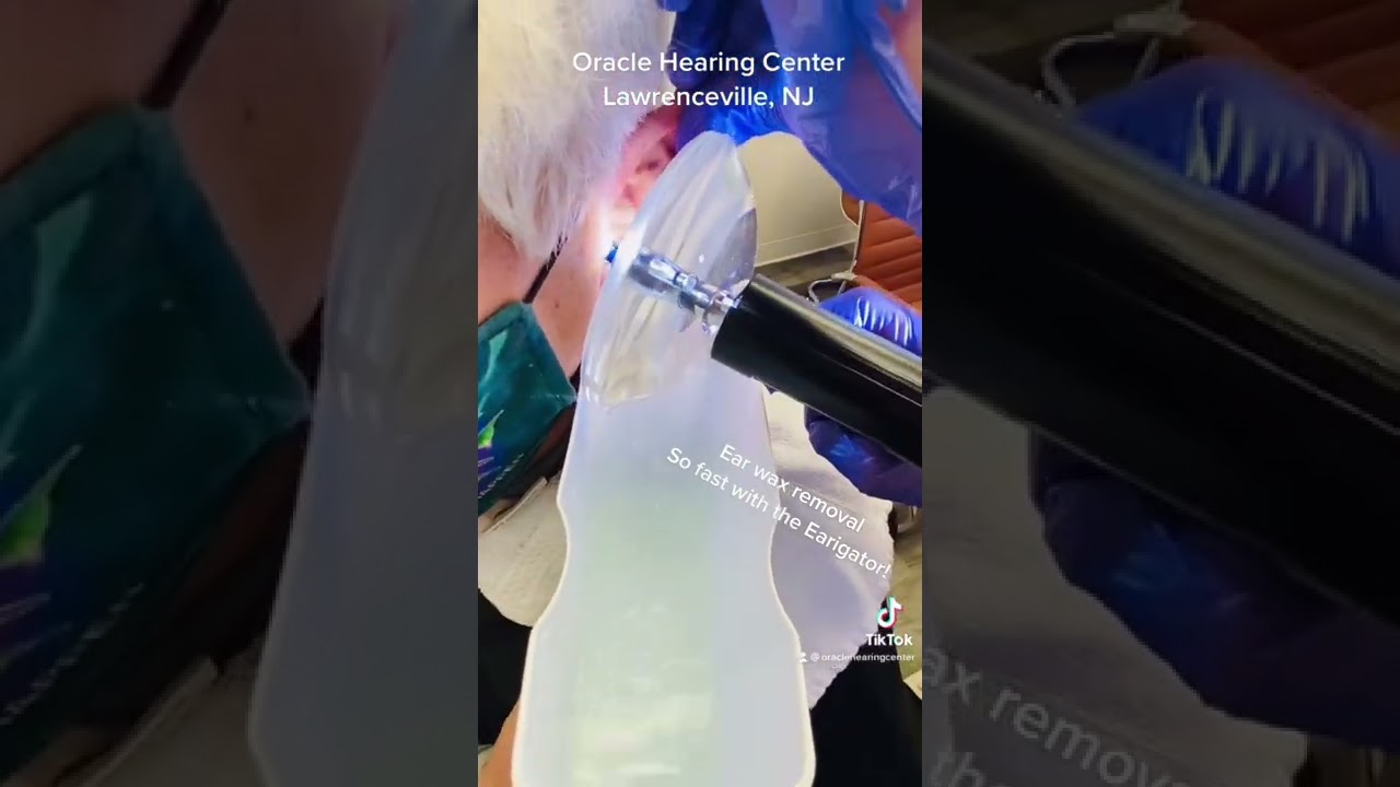 Ear wax removal is so fast with the Earigator.  Don&rsquo;t blink!