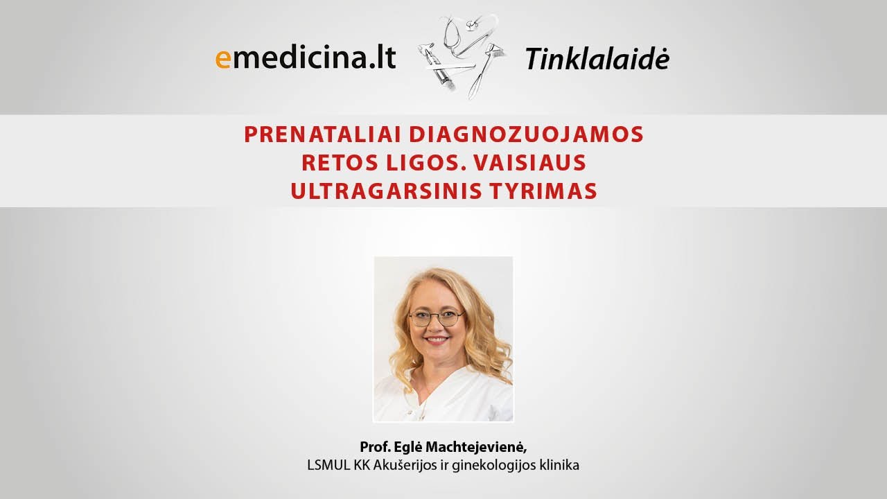 AKUŠERIJA, GINEKOLOGIJA. Prenataliai diagnozuojamos retos ligos. Vaisiaus ultragarsinis tyrimas