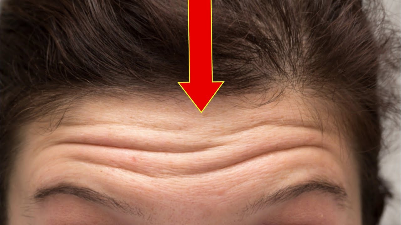 क्या आपके माथे पर ऐसी रेखाएं बनती है? Forehead Lines meaning