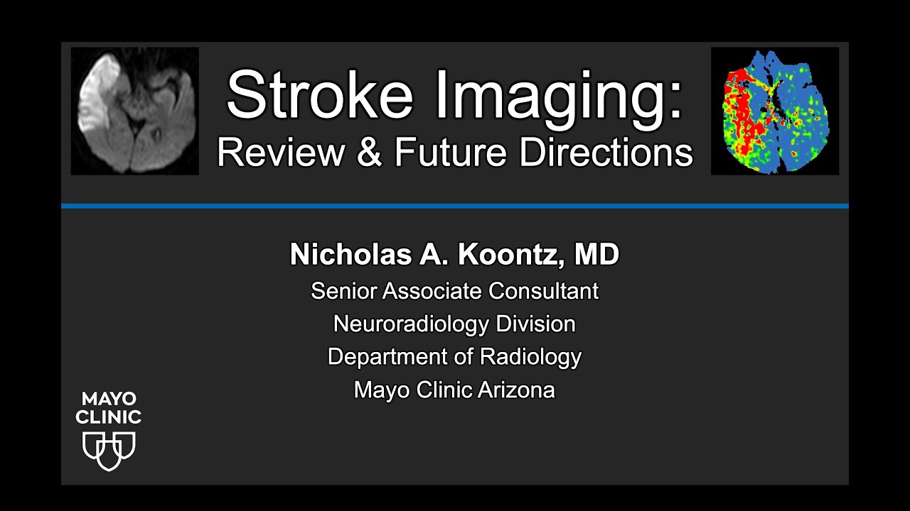 Stroke Imaging: Review and Future Directions
