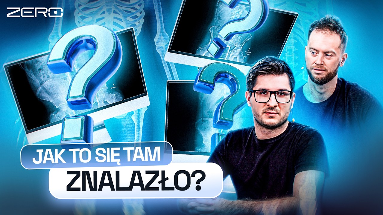 CO LEKARZE WYJMUJĄ Z&hellip; PACJENT&Oacute;W I ZERO ZNIECZULENIA