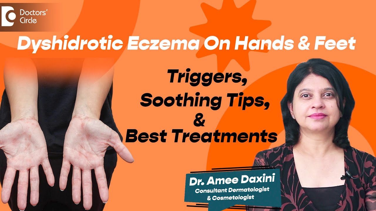 Itchy Hands & Feet | Dyshidrotic Eczema - Triggers & Home Remedies - Dr. Amee Daxini|Doctors' Circle