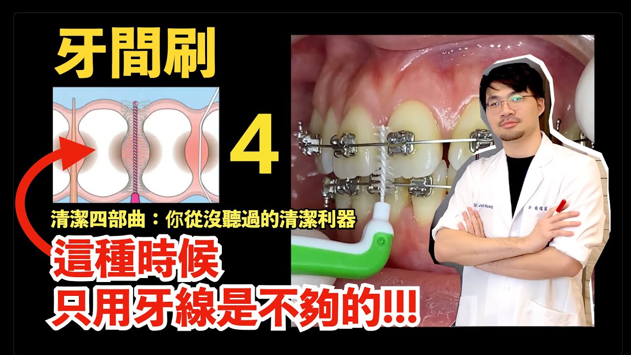 【牙線不是萬能的】在『那個時候』牙線很廢，你需要牙間刷這個酷玩意