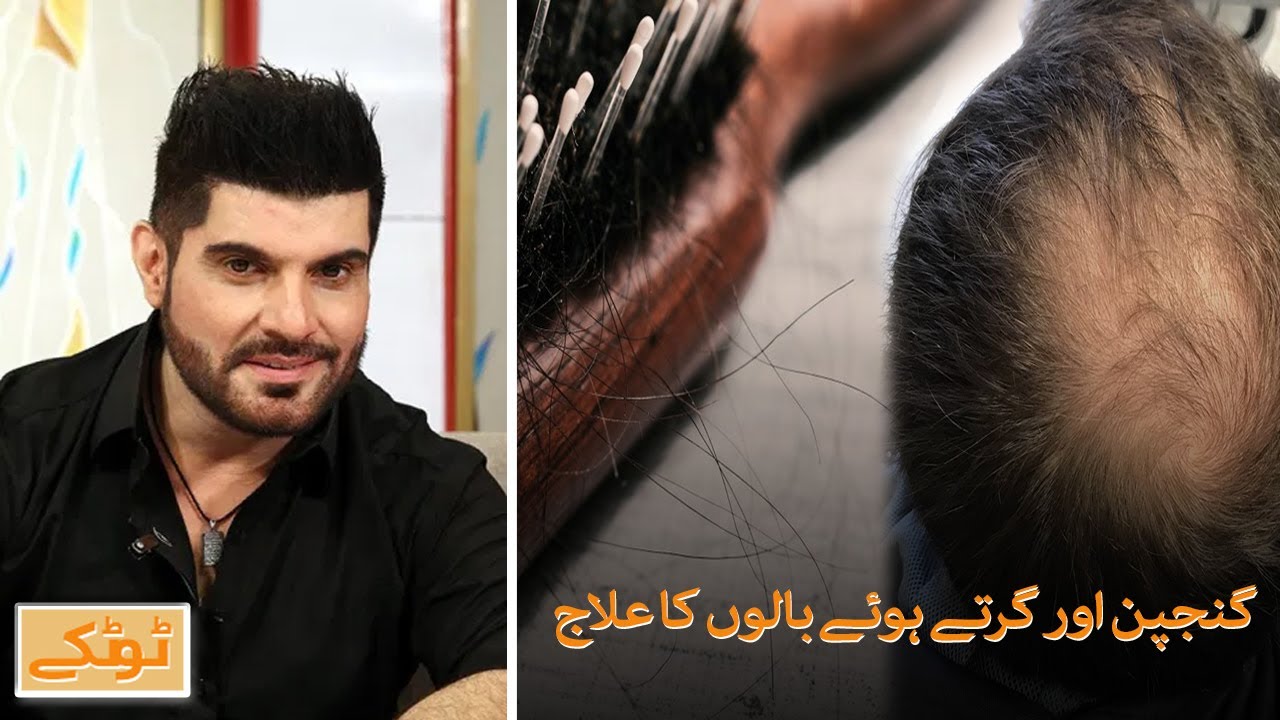 Ganjpan aur girtay hoa baalon ka ilaj | Naya Din | SAMAA TV